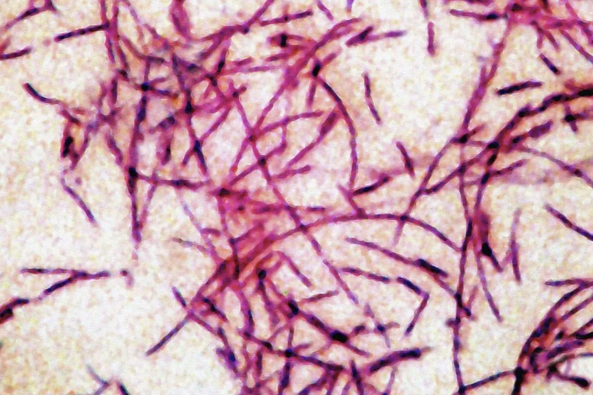 Legionnaires' disease